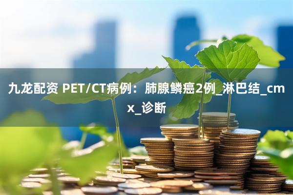 九龙配资 PET/CT病例：肺腺鳞癌2例_淋巴结_cmx_诊断
